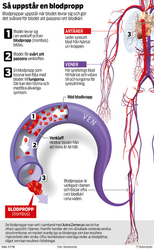 Så Uppstår En Blodpropp